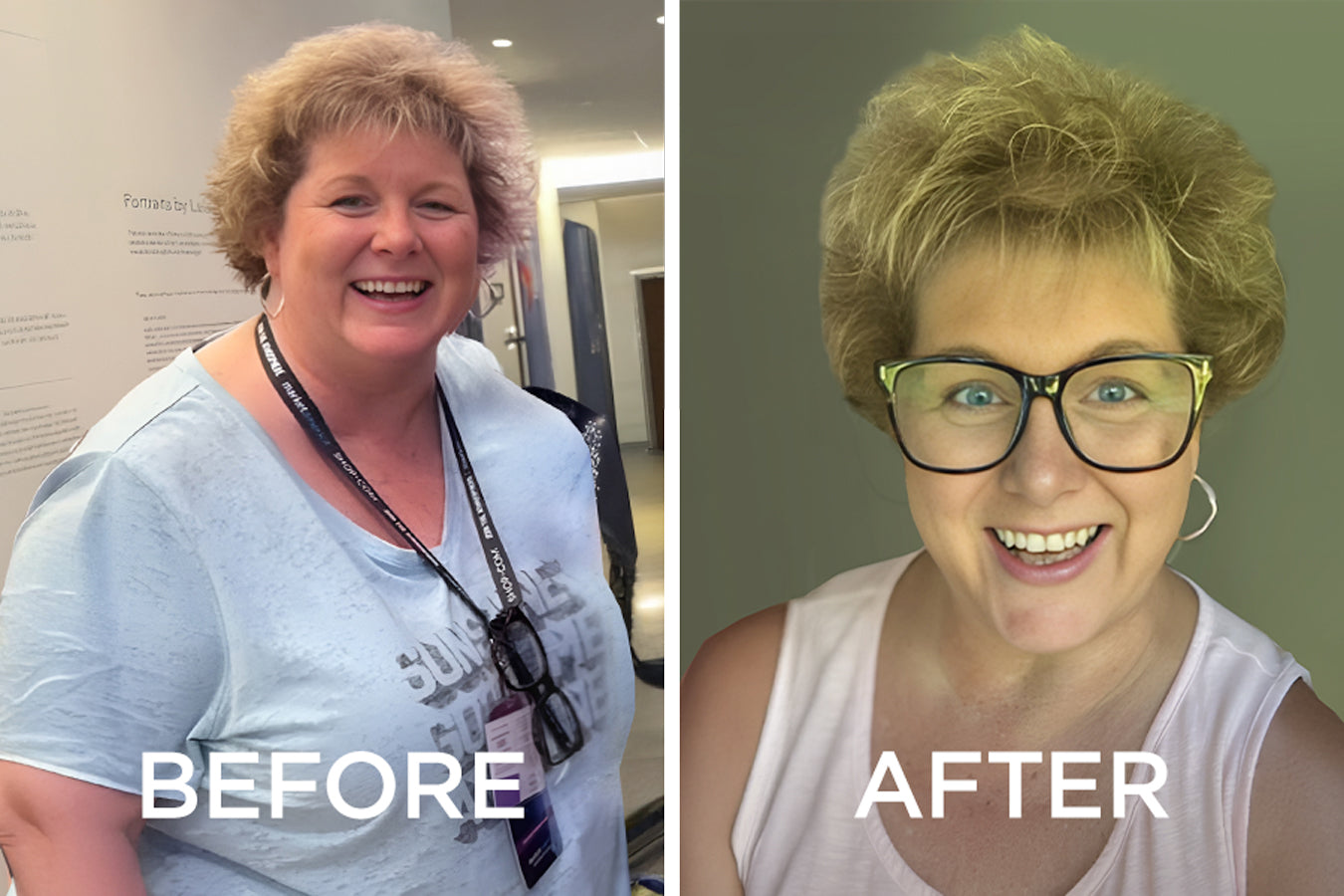 before and after image of a woman who used GoTrim Thin