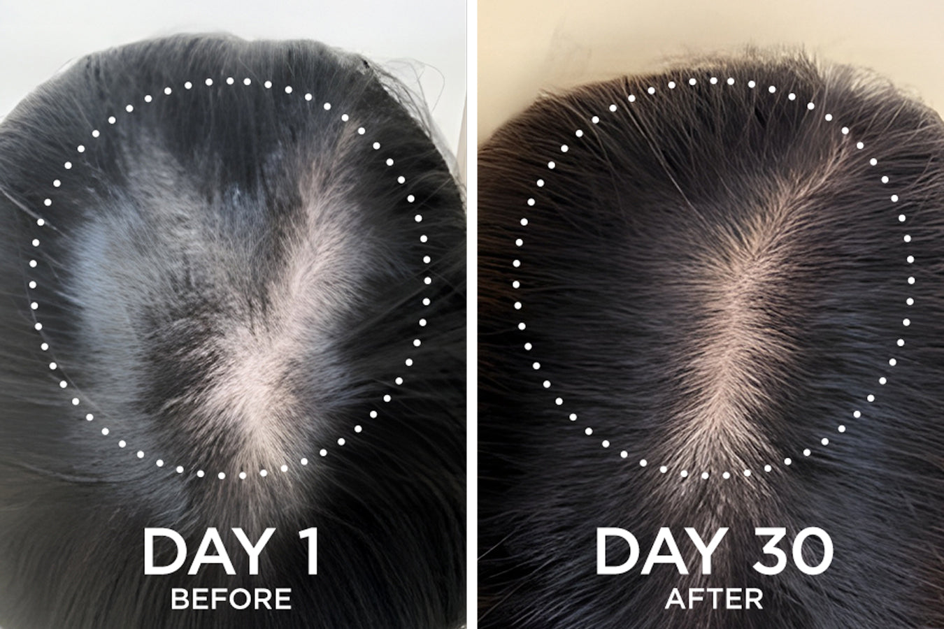 before and after images from a Fixx Hair Growth product user