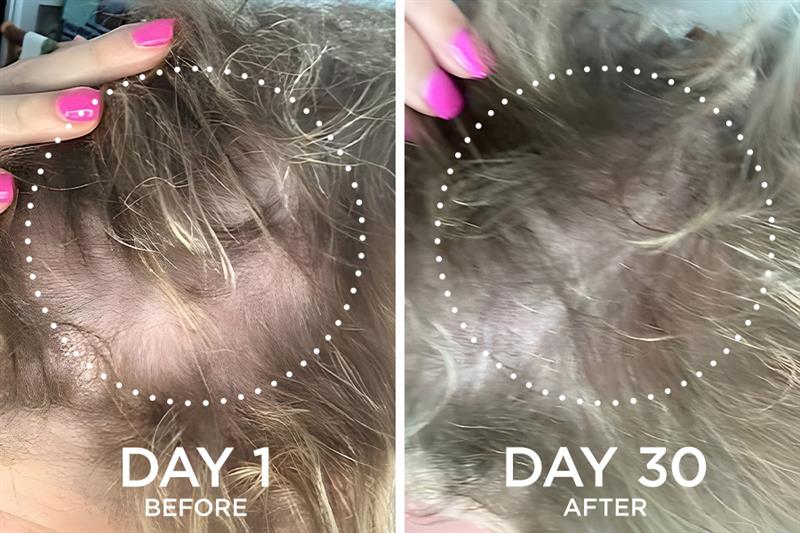 before and after images from a Fixx Hair Growth product user