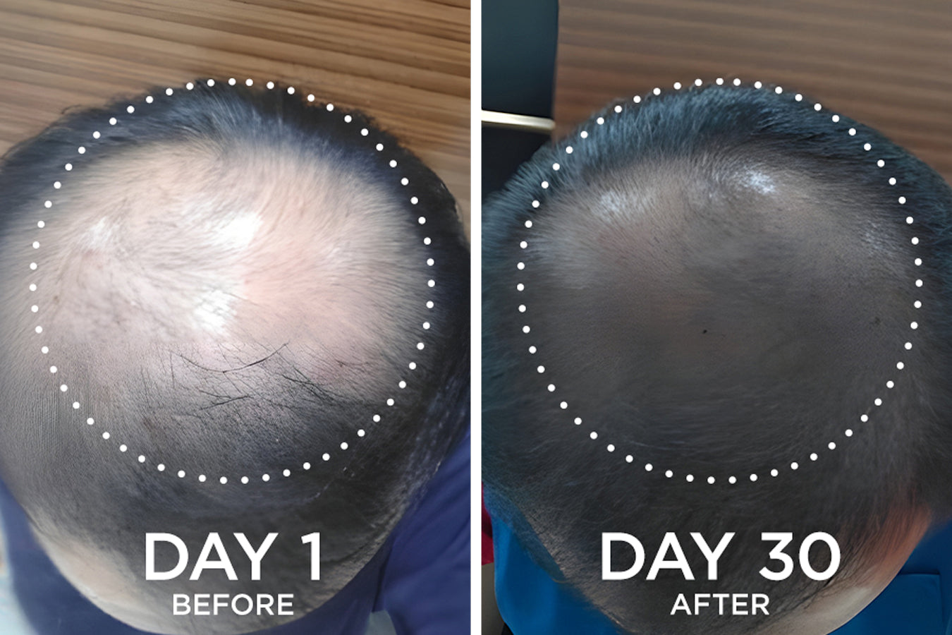 before and after images from a Fixx Hair Growth product user
