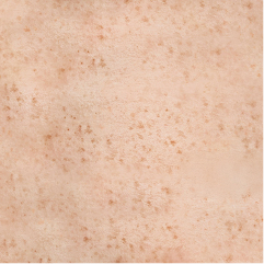 A close-up texture shot of light beige skin with scattered small brown freckles or moles.