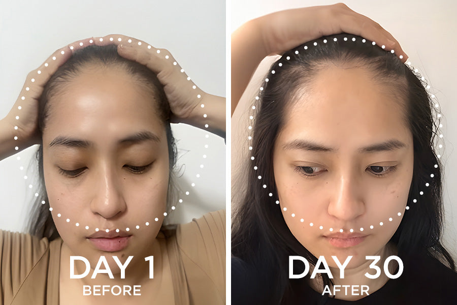 before and after images from a Fixx Hair Growth product user