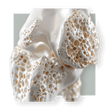 image of bone