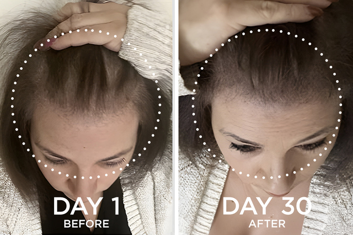 before and after images from a Fixx Hair Growth product user